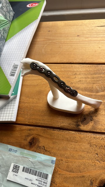 My Collarbone Ex Vivo